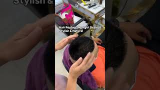 Hair Replacementget Human Hair patch in Superb Quality at Touch Derma clinic80778432577840050530 [upl. by Sukramed475]