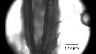 Quantification of Drosophila Larva Heart Function Using Microfluidics by Alireza Zabihihesari [upl. by Ingham]