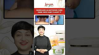 Nigricans Acanthosis Cure Dark Neck And Flaunt It  Juvena Herbals [upl. by Rozalie]