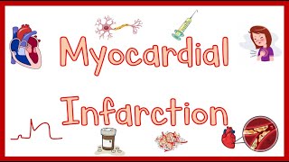 Myocardial InfarctionHeart Attack Causes Pathogenesis Signs amp Symptoms Diagnosis amp Treatment [upl. by Quigley806]