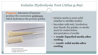 Gelatin Hydrolysis Test  Microbiology Class  Podcast CC [upl. by Icat]