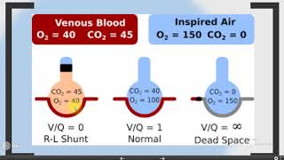 physiology ventilation perfusion relationships [upl. by Terrill]