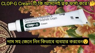 ClopG Cream এর কাজ কিদাম সহ জেনে নিন ব্যবহার করার নিয়ম  ফর্সা হওয়ার ক্রিম  ClopG Cream Review [upl. by Reilamag]