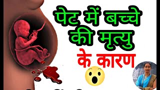 गर्भ में ही बच्चे की मृत्यु क्यों हो जाती है। Intrauterine fetal death [upl. by Kerekes]