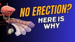 Unveiling the Mysteries of Not Having an Erection [upl. by Yecies]