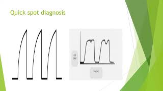 Capnography in Anaesthesia and Critical Care [upl. by Neyrb]