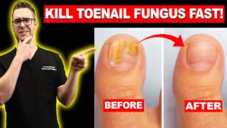 1 BEST Toenail Fungus Treatment Top 10 Home Remedies 2024 [upl. by Cutter]