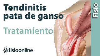 Tendinitis de la Pata de Ganso Ejercicios consejos y recomendaciones de un fisioterapeuta [upl. by Katey251]