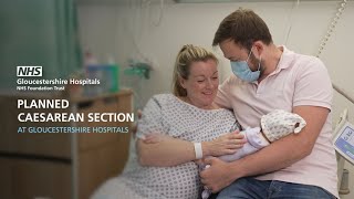 Having a Planned Elective Caesarean Section at Gloucestershire Hospitals [upl. by Jena]