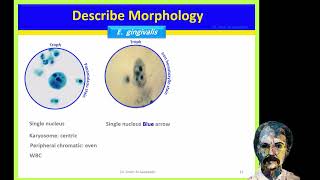 Diagnostic Parasitology Entamoeba gingivalis Naegleria fowleri Balamuthia and Acanthamoeba [upl. by Ecilahs]