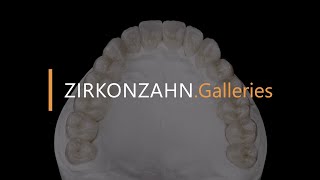 Complete restoration made with Prettau® 4 Anterior® zirconia  ZirkonzahnGalleries [upl. by Dorn]