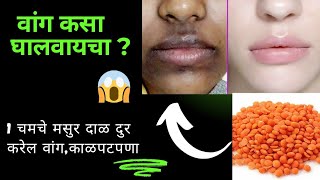 Masoor dal face pack for pigmentationHow to remove pigmentation from face naturally [upl. by Ramo]