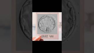 Good Quality Day 5 Blastocyst Embryo 👼🏻blastocyst [upl. by Adikam779]