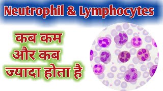 Neutrophil high Causes  Lymphocytes high Causes  Low Neutrophil  Low Lymphocytes [upl. by Wickham]