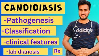 Candidiasis microbiologypathogenesislabdiagnosisTreatment [upl. by Ttenyl]