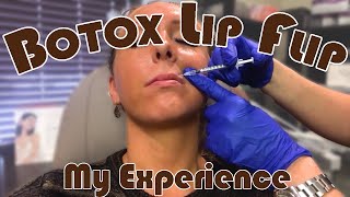 Getting a Botox Lip Flip  My Honest Experience  Before amp After  Botox Injection Footage [upl. by Letniuq]