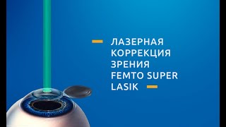 Фемто Супер ЛАСИК Femto Super LASIK  операция лазерной коррекции зрения [upl. by Bessie]