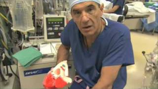 Heart Valve Replacement Surgery Explained Part 1 [upl. by Shaddock]