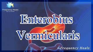 Enterobius Vermicularis Infection Healing  Energy amp Quantum Medicine  Healing Frequency [upl. by Lynus]