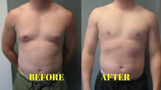 how to get rid of gynecomastia at home without surgery [upl. by Doownil]