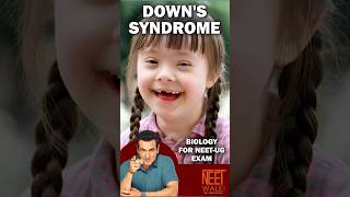 Downs syndrome  A genetic chromosomal Disorder  Down syndrome cause symptom diagnose neet [upl. by Attenev]