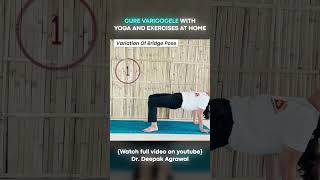 Yoga Aasan for Varicocele at Home  Part 4 varicoceletreatment yogaasanas [upl. by Debbra]