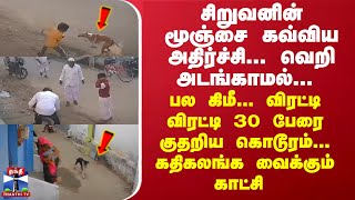 சிறுவனின் மூஞ்சை கவ்விய அதிர்ச்சி 30 பேரை குதறிய கொடூரம் கதிகலங்க வைக்கும் காட்சி [upl. by Crowns]