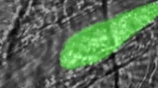 Real time thrombus formation after a laserinduced injury [upl. by Eelidnarb]