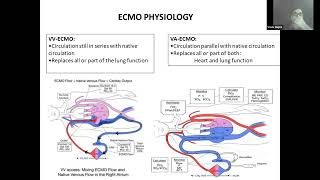 01 Ventilation strategy during ECMO by Dr Vivek Gupta ECMO INDIA OCT 2024  Day 02 [upl. by Freeman]