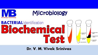 BIOCHEMICAL TEST  Bacterial Identification Technique  Microbiology  Vivek Srinivas Bacteriology [upl. by Simpkins]