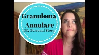 Granuloma Annulare My Story [upl. by Lola]