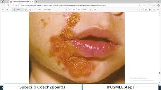 Chp41 Pharma Lippencott  Drugs used to treat Superficial Skin Infections [upl. by Drahcir37]