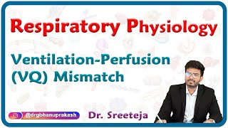 Ventilationperfusion VQ mismatch  Respiratory physiology USMLE Step 1 [upl. by Eelessej]