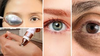 Dark Circles  Puffy Eyes Easy amp Simple Treatment with these Amazing Product Urdu Hindi [upl. by Arihaj]