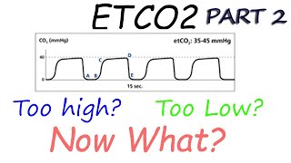 Capnography Waveform Interpretation Advanced  Why perfusion matters [upl. by Nerw]