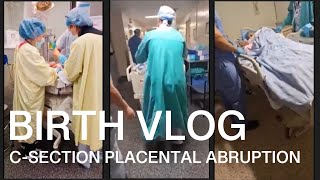 Emergency C Section due to Placental Abruption  transverse baby position [upl. by Irmgard50]