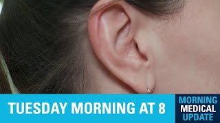 Morning Medical Update  Pulsatile Tinnitus [upl. by Ioved]