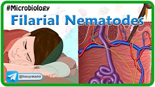 Filarial nematodes Animation🐛 Wuchereria onchocera volvulus LoaLoa Dracunculus Trichinella [upl. by Naik]