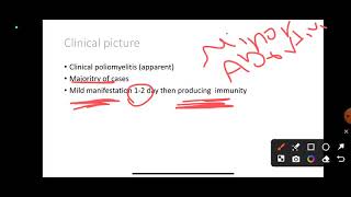 L14 Poliomyelitis COM41 [upl. by Corb550]