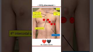 ECG placement ❤️ecg medical trending education [upl. by Jarid]