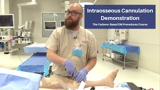 Intraosseous Cannulation Demonstration  The CadaverBased EM Procedures SelfStudy Course [upl. by Howland861]