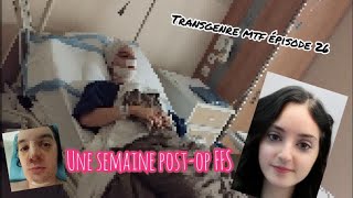 Transgenre mtf épisode 26 Une semaine post op FFS [upl. by Rafaela]