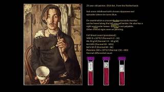 Polycythaemia  The redfaced artist  Full Blood Count Masterclass series [upl. by Ahsiele419]