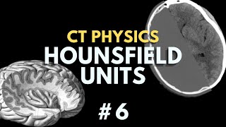 How to calculate Hounsfield Units and CT Windowing  Computed Tomography Radiology Physics Course 6 [upl. by Edny]