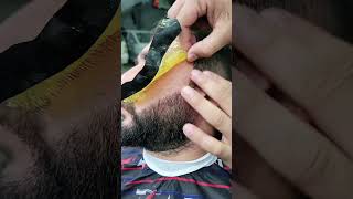 ازاله شعر الادقن بالشمع 😂✂️💈 fun funny funnyvideo foryou comedy viralvideo fyp [upl. by Ahseined885]