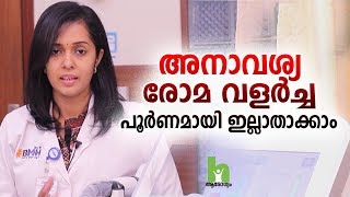 അനാവശ്യ രോമ വളർച്ച പൂർണമായും ഇല്ലാതാക്കാം  Laser Hair Removal Malayalam Health Tips [upl. by Anahsak]