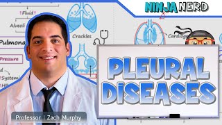 Pleural Diseases Pleural Effusion Pneumothorax  Clinical Medicine [upl. by Nazler]