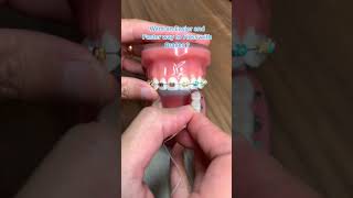 Easier Way to Floss with Braces  Platypus Floss [upl. by Annaek]