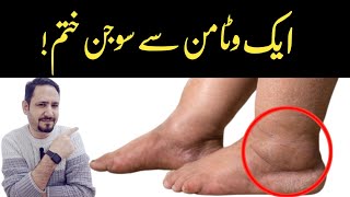 1 Vitamin To Eliminate Swelling In Feet and Legs  Dr Irfan Azeem [upl. by Noevad]