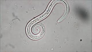 Aelurostrongylus abstrusus feline lungworm [upl. by Ingrid]